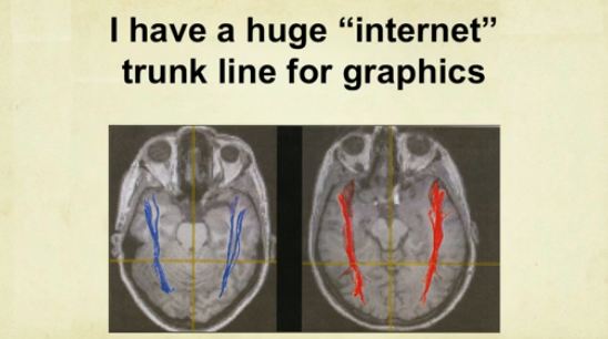 temple granding presenting her brain tensor imaging